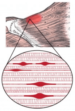 RJM Therapy - Trigger Point